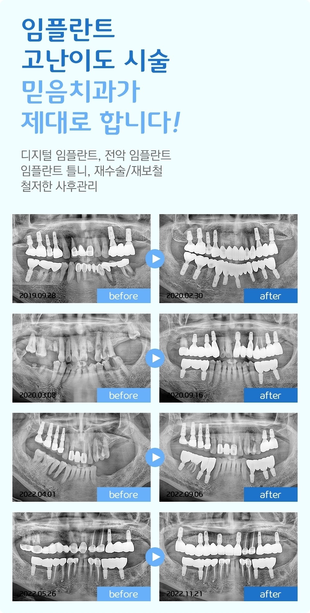 안양치과추천 8