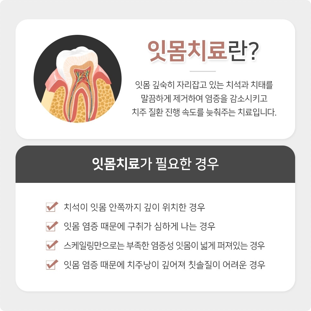인덕원임플란트 사후관리까지 꼼꼼하게 14 인덕원임플란트 13