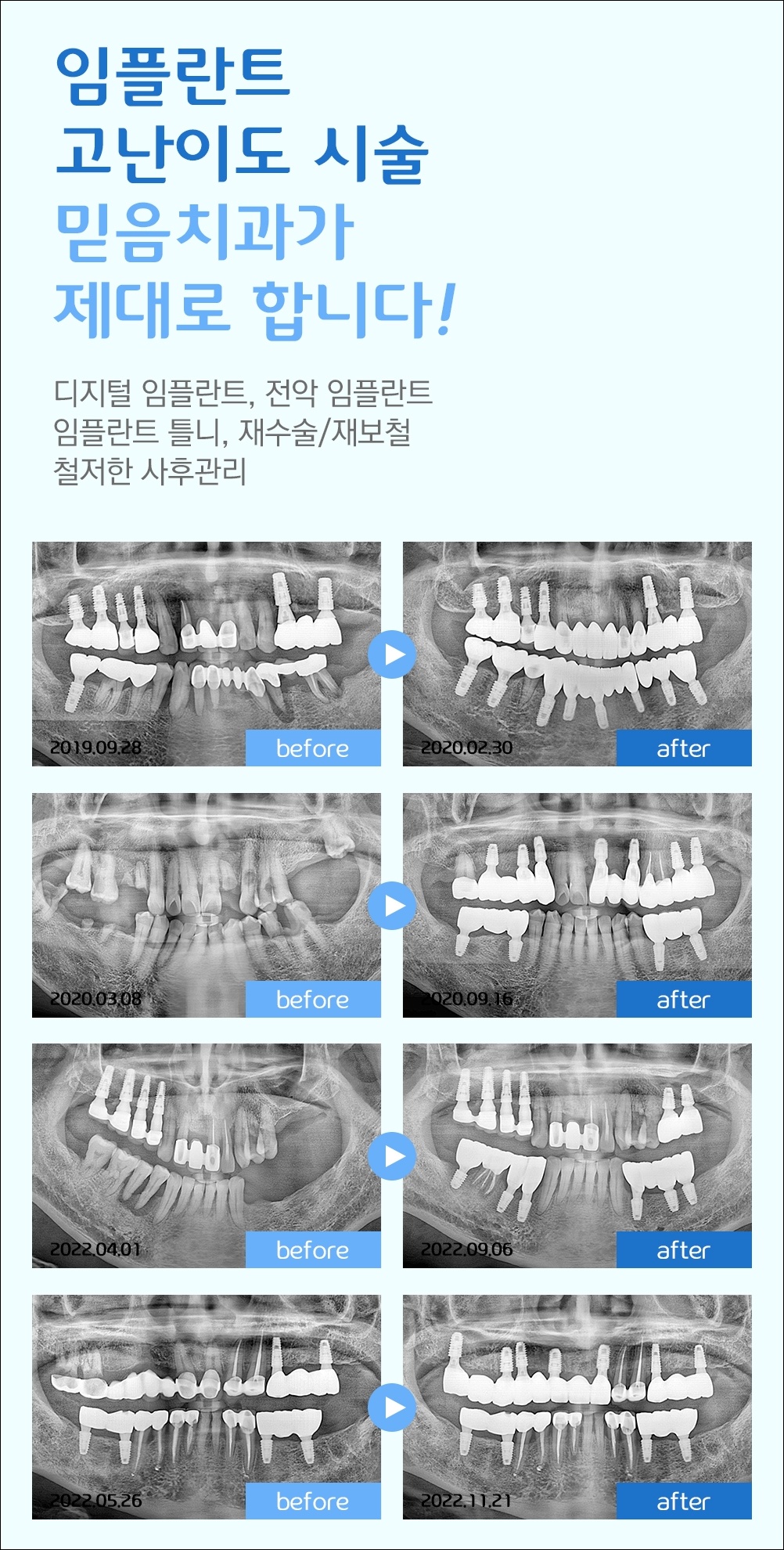 인덕원양심치과7