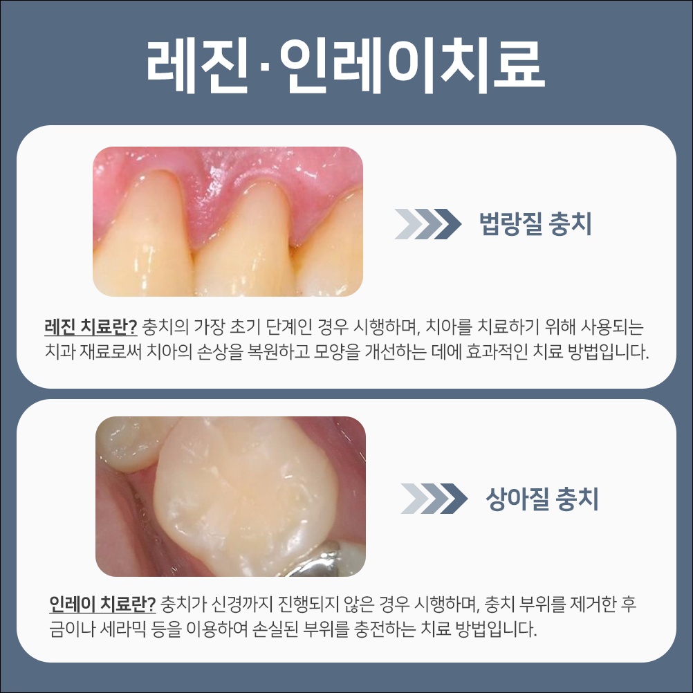 인덕원양심치과9